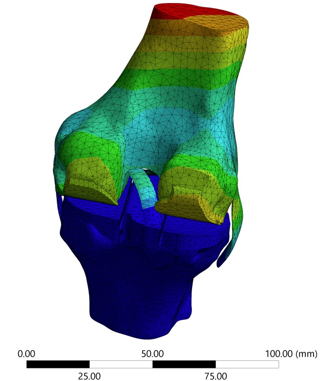 FEA in Medical Engineering