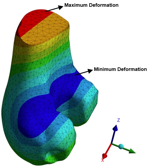 FEA in Medical Engineering
