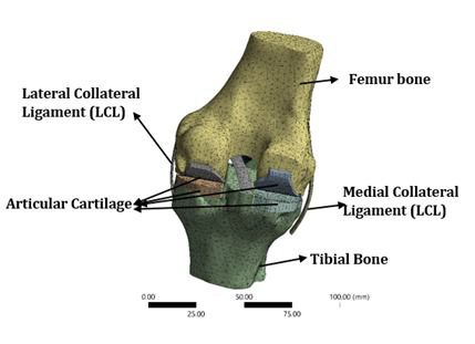 FEA in Medical Engineering